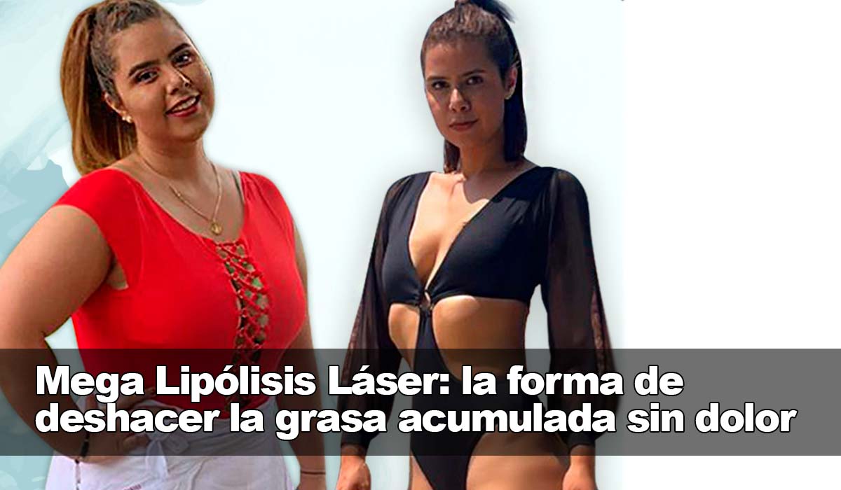 La Mega Lipólisis Láser: la solución efectiva para adelgazar la grasa sin preocupaciones